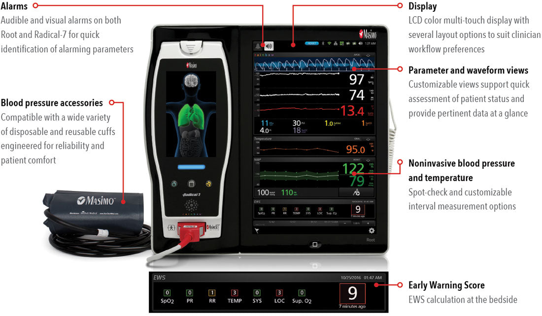 Masimo ROOT monitor with Masimo SpO2, NiBP, Temp – Medical